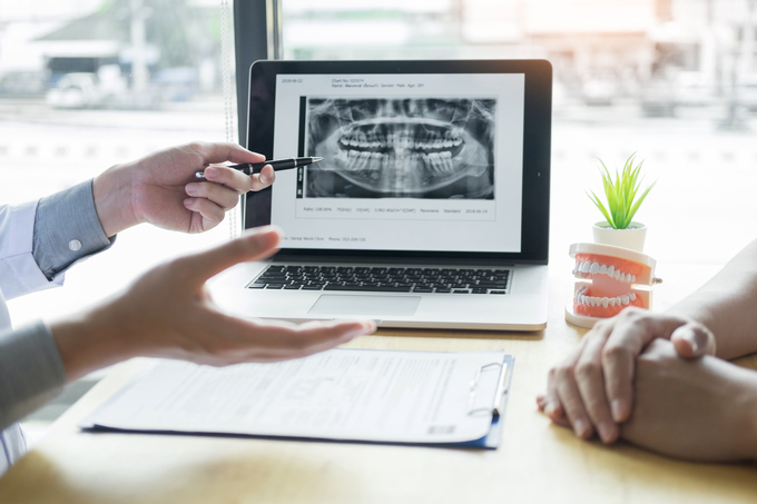 中目黒ゲートタウン歯科室のインプラント