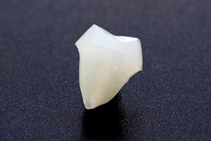 中目黒ゲートタウン歯科室の審美治療