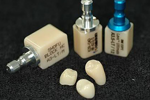 中目黒ゲートタウン歯科室の審美治療