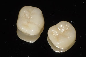 中目黒ゲートタウン歯科室の審美治療