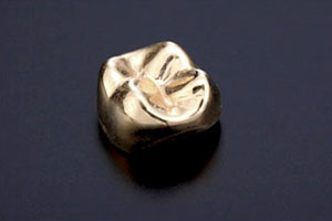 中目黒ゲートタウン歯科室の審美治療