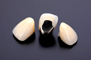 中目黒ゲートタウン歯科室の審美治療