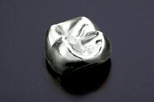 中目黒ゲートタウン歯科室の審美治療