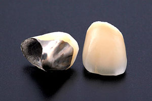 中目黒ゲートタウン歯科室の審美治療