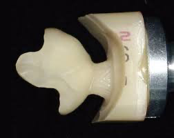 中目黒ゲートタウン歯科室の審美治療