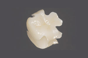 中目黒ゲートタウン歯科室の審美治療