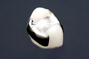 中目黒ゲートタウン歯科室の審美治療