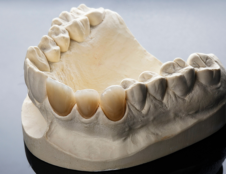 中目黒ゲートタウン歯科室のインプラント