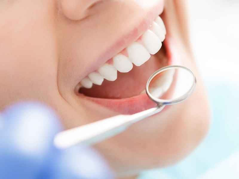 中目黒ゲートタウン歯科室の予防・クリーニング